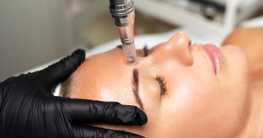 میکرونیدلینگ: چگونه جای زخم‌ های قدیمی آکنه را برای همیشه محو کنید؟
